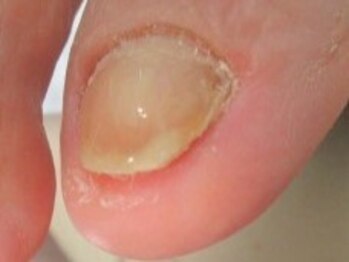 東京巻き爪研究所 みなみ風/