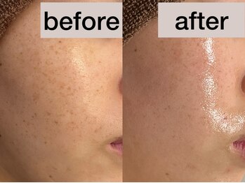 サロンリー(Salon Riee)/肌改善&シミケア