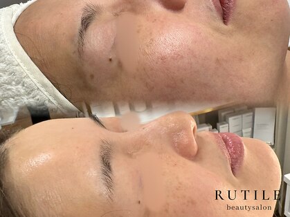 ルチル 八女店(Rutile)の写真