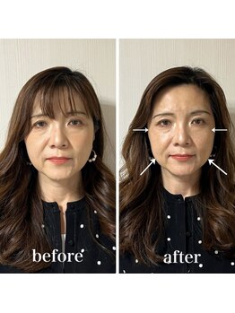 ラリマール/お客様ビフォーアフター