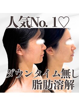 ミタメ 銀座店(MITAME)/気になるあご下のお肉に