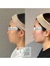 【歪み&左右差 特化】小顔矯正+手技リンパケア¥8,800→¥6,600