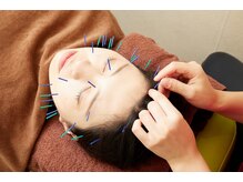 はら鍼灸整骨院 伊勢院/美容鍼