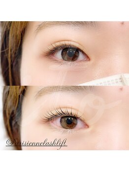 イト(ito)/パリジェンヌBefore After