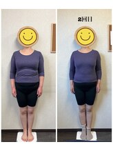 パルフェ(THE Parfait)/美容整骨【全身矯正】