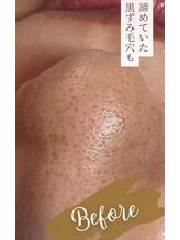 オウカ(OUKA)/毛穴メニューに特化してます