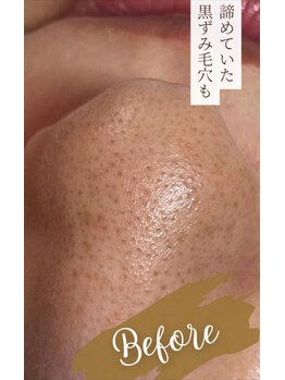 オウカ(OUKA)/毛穴メニューに特化してます