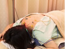 健康堂 綱島駅前店/背中の鍼通電施術