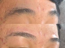 シーアットシュシュ(C at Chouchou)/メンズ眉毛Wax脱毛