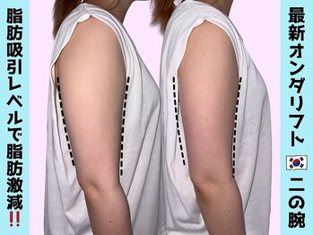 オンダリフト東京　大阪梅田店【韓国肌管理】オンダリフト/ララ ピール/小顔矯正/痩身/オンダリフト/梅田/ララピール
