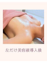 ワム(Wom)/オプション美容導入/枚方/バスト