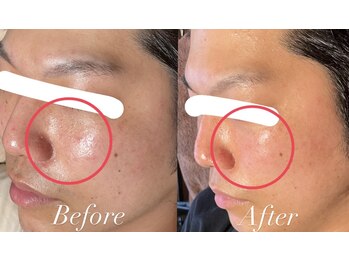 ヴィーナス 三ツ境店(VENUS)/オーガニック100％フェイシャル