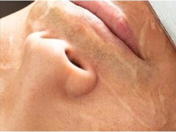 グラリス(GRALYS)の写真/【メンズ脱毛&フェイシャル】期間限定割引を開催中★人気脱毛器バイマッハプロ導入でお肌に圧倒的自信を！