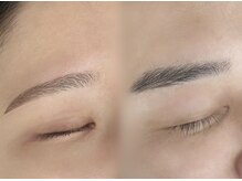 Q6.ワックス脱毛とは何ですか？