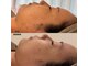 アールエーサロン 恵比寿 広尾(Ra salon)の写真