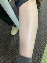 ミンエピ(MinEpi)/ご自身の足と比べてみて下さい♪