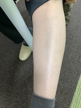 ミンエピ(MinEpi)/ご自身の足と比べてみて下さい♪