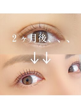 オハナ アイラッシュサロン 武蔵小杉店(Ohana)/人気美容液エグータム♪