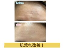 ルフレ(Rufure)/劇的ビフォーアフター♪