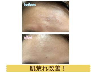 ルフレ(Rufure)/劇的ビフォーアフター♪