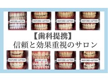 【歯科提携】歯のホワイトニング専門店 ホワイトニングサロン宝塚