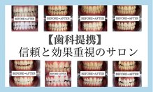 【歯科提携】歯のホワイトニング専門店 ホワイトニングサロン宝塚