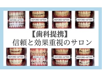 ホワイトニングサロン 宝塚