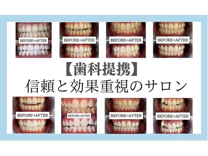 【歯科提携】歯のホワイトニング専門店 ホワイトニングサロン宝塚の写真
