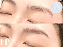 怪我で一部生えていない箇所もこの通り！ナチュラルに◎