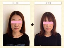 美容整体 ウェリナ 蟹江院/小顔矯正/骨盤矯正/美脚サロン