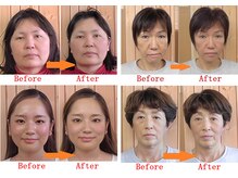 【小顔整体/骨盤矯正】愛知気功整体 肩こり/頭痛/小顔/首痛/整体/小顔矯正/美容整体の雰囲気（ほうれい線やたるみ改善★気になる左右バランスも◎姿勢改善まで）