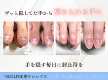 ブルームーンネイルズ(BLOOMOON.nails)