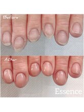 エッセンス (Essence)/指先の角質,ささくれもリセット!