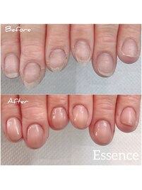 指先の角質,ささくれもリセット!