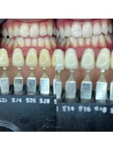 トウキョウスワーズ 池袋店(TOKYO SWRS)/#ホワイトニング #池袋 #渋谷