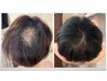 四国初★育毛促進トータルケア（初回ヘアケア製品１本付）￥17,500→￥12,000