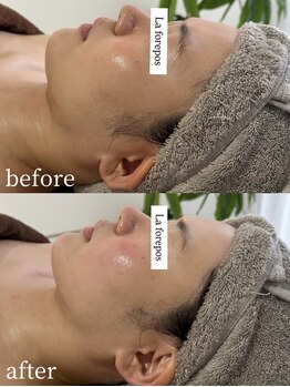 ラ フォルポ 恵比寿(La forepos)/ハーブピーリング恵比寿代官山