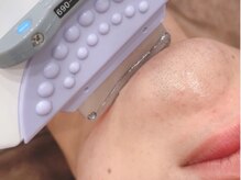 あおのアルパカ