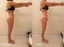 クロレ 浦和店(CLORE)/30代のお客様/5回施術