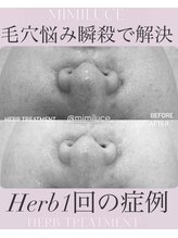 ミミルーチェ(mimiluce)/《毛穴レス》ハーブピーリング