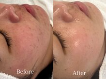 リフコウベ(LIF KOBE)/艶肌wax+アンストレス1回