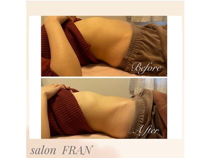 フラン(FRAN)の写真