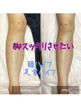 ジューヌ(Jeune)/