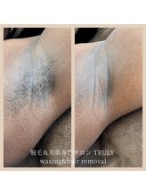 トゥルーリー(TRULY)/《Waxは肌色を問わない♪》