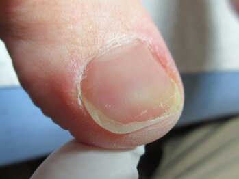 東京巻き爪研究所 みなみ風/