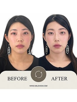 ミラビュー(MILOVIEW)/パーソナルメイクレッスン