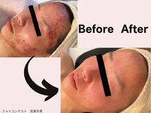 ミネルバエンダモロジー/エンダモロジー/フェイシャル