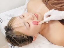 リアココ(Ria.COCO)/お顔脱毛