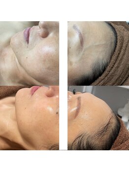 ナチュレ(Nature)/ハリツヤくすみ、シミ改善にも◎