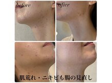 シェリー(Cherie)の雰囲気（最高級アロマを使用した腸もみマッサージで一度でも驚きの変化！）